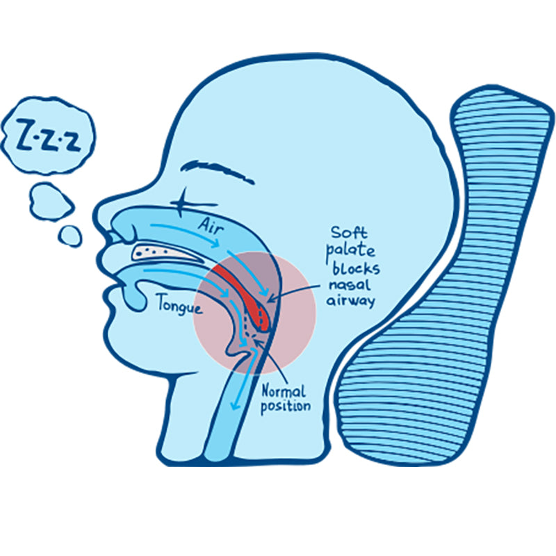 You need to know the reason for snoring
