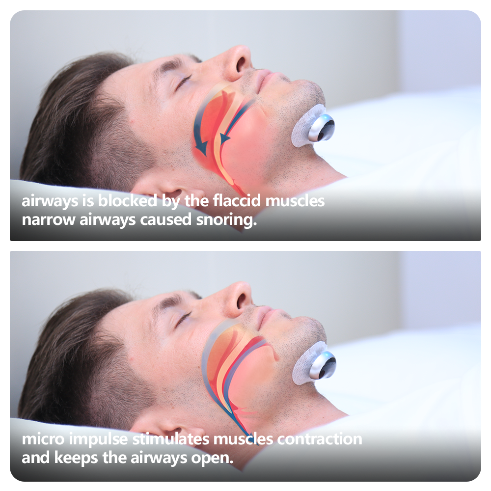 Open image in slideshow, Snore Circle YA4200 Electronic Muscle Stimulator Plus
